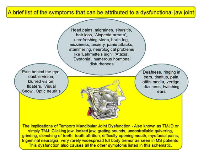 Dr Amir Symptoms Dysfunctional Jaw Joint