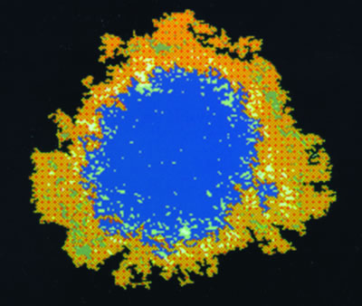 Image of HCV based on electron micrograph