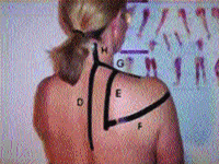 Trigger points for mid back, shoulder and neck pain