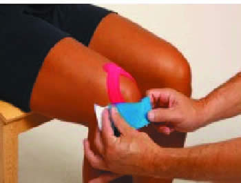 Taping Man's Knee