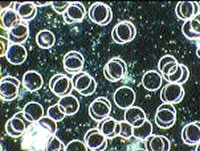 Candida visualized using dark field microscopy