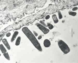 Fig. 1: Electron micrograph showing lactobacilli adhering to the squamous epithelium of the pig stomach