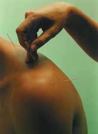 Acupuncture and Traditional Chinese Medicine attempts to restore balance to the endocrine system
