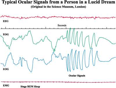 Ocular signals from a person in a Lucid Dream