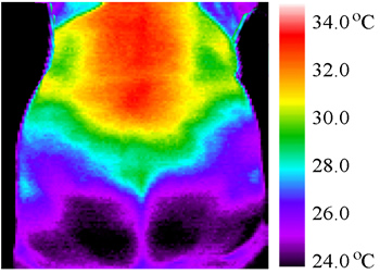 Fig. 5. Infra red image of Victoria's back before any treatment