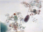 Giardia lamblia