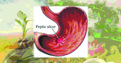 Peptic ulcer