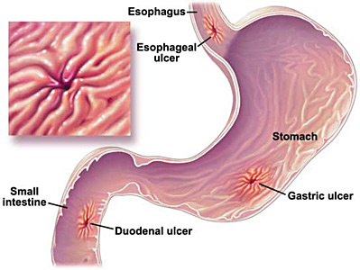 Intestine