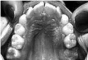 Figure 5. Curve of Spee