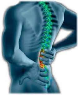 Back Pain image