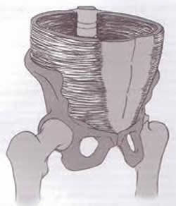 Transverse Abdominis image