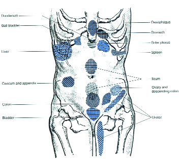 Areas of referred pain