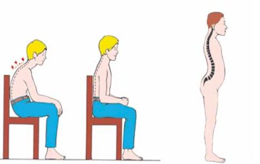 Postural Strains and Sprains. Poor posture and working habits place excessive strain on muscles, ligaments and joints.  Far Right: The sections of the spine.