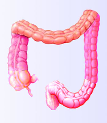 Colon image