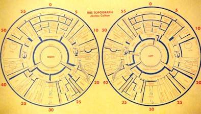 Figure 2 The British Iris Chart