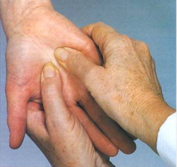 Eczema Ringworm