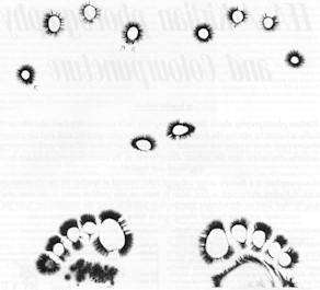 Figure 1 shows the ciliary crown of a client. This picture helps describe in brief the main meaning of each fingertip and toe