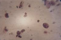 Photograph of parasite eggs