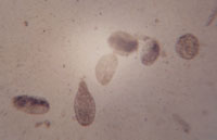 Photograph of parasite eggs
