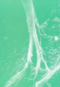 A collagen fibre branches as it enters a parasutral bone from the space of the sutre where it is part of a fibrous web connecting with the other parietal bone