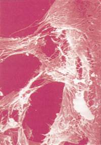 Cross section through a sutural blood vessel showing invasion by the autonomic nerve plexus which served it