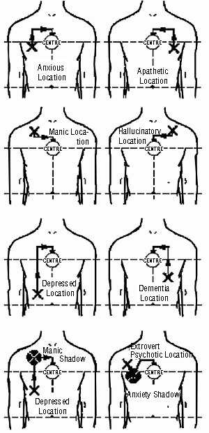 Figure 17 Shifting direction