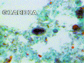 Electromicrograph of Giardia lamblia
