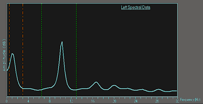 The trace in Figure 7 clearly shows a good peak in the alpha region indicating subject in a very relaxed mental state.