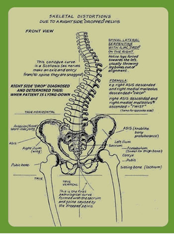 Skeletal Distortions chart