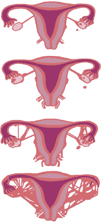 Positive Health Online | Article - Endometriosis: A Nutritional Approach