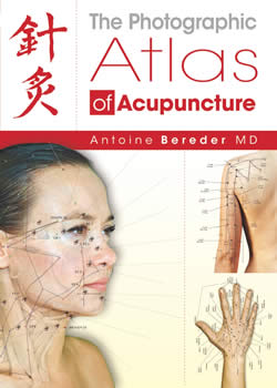 Photographic Atlas of Acupuncure