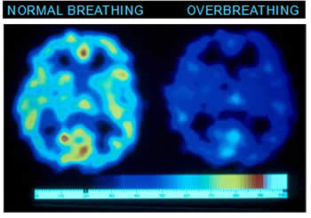 Magnetic Resonance