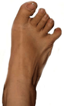Joel Carbonnel toes