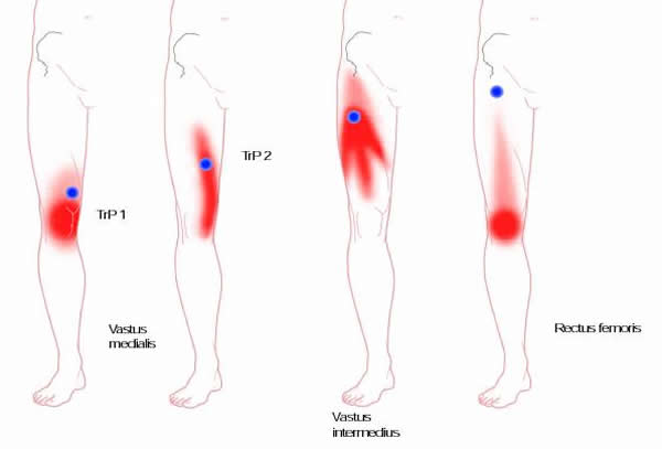 Muscle Pressure Points Chart