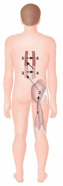 Correct firing pattern of hip joint extension.