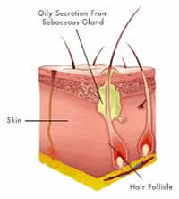 sebaceousgland