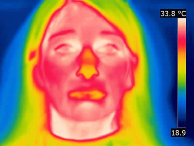 Thermal image patient B