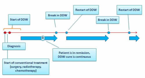 Protocol for Integration of Deuterium depletion into Complex Oncotherapy