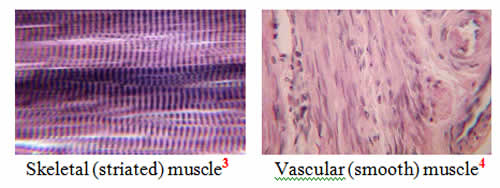 muscles----smooth and striated image