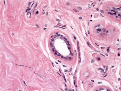 Normal tissue with well structured stroma