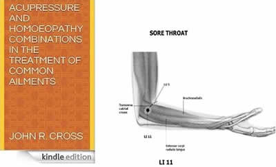 Acupressure and Homoeopathy Combinations in the Treatment of Common Ailments