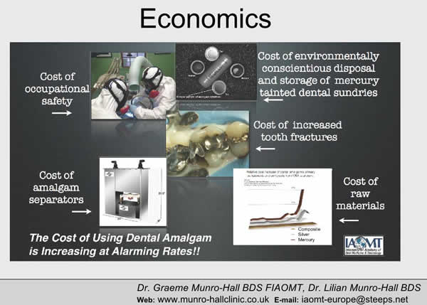 Cost of Using Dental Amalgam