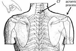 Gallbladder