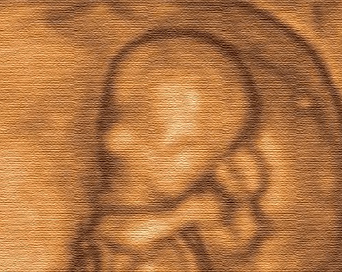 Pandey 226 4D Ultrasound Scan