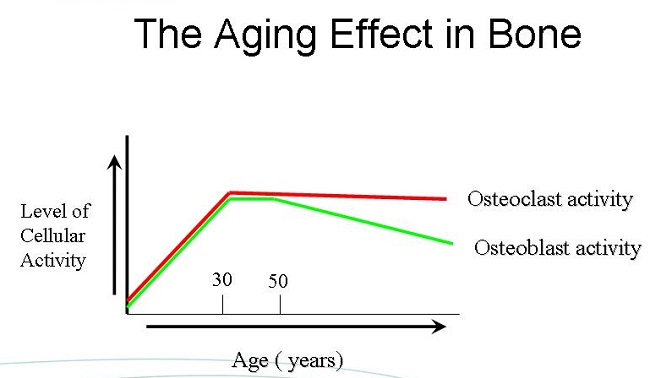 Ageing Effect in Bone