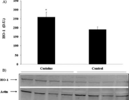 Heme oxygenase-1