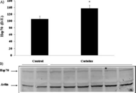 Hsp 70 Inducible shock protein