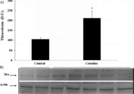 Thioredoxin protein levels