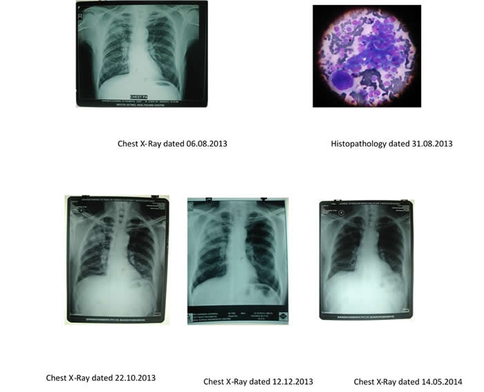 Chest X-Rays and Histopathology.