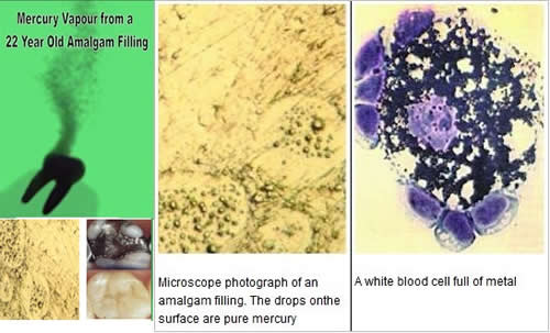 Relationship Between Heart Disease and Dental Treatment